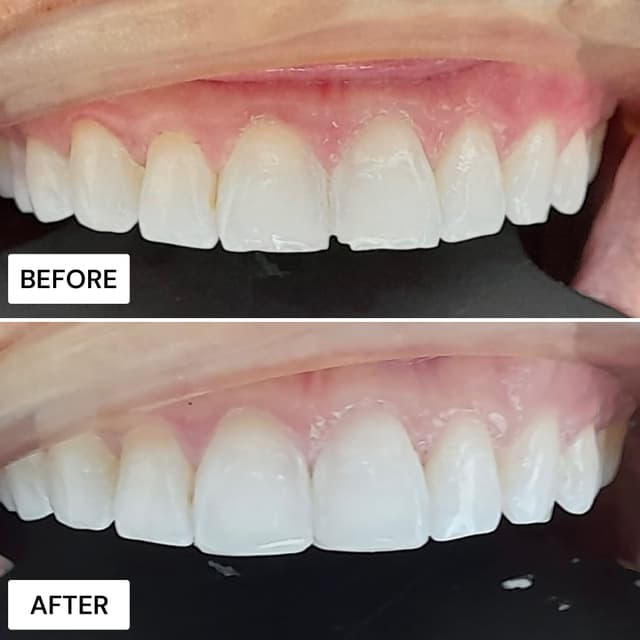 Before and after result
