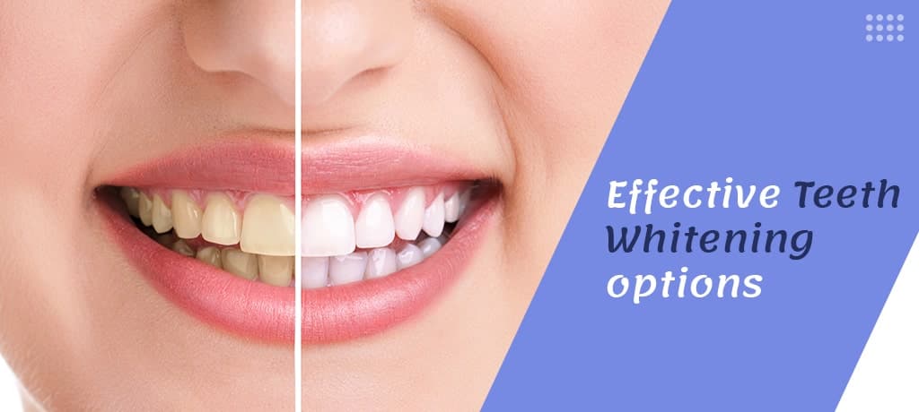 Dental Hygienist vs. Dentist: What's the Difference?