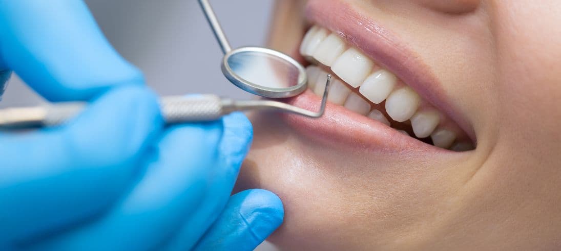What to Expect During a Professional Teeth Cleaning Session?