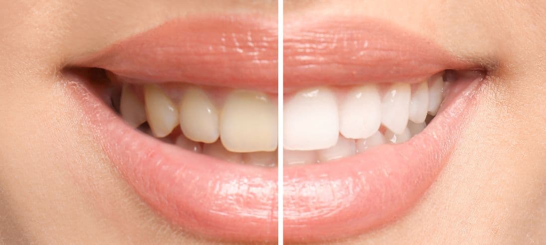 Deep Cleaning vs Routine Cleaning: Key Differences