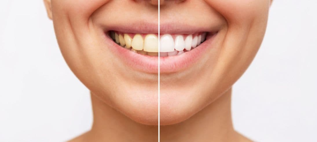 How Office Work Habits Affect Dental Health
