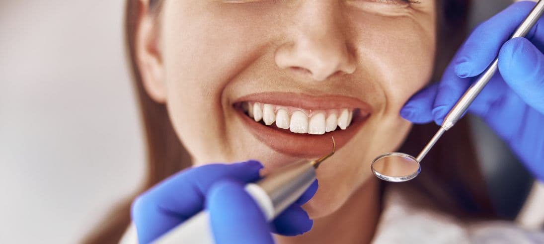 How to Polish Composite Bonding Without Damaging It
