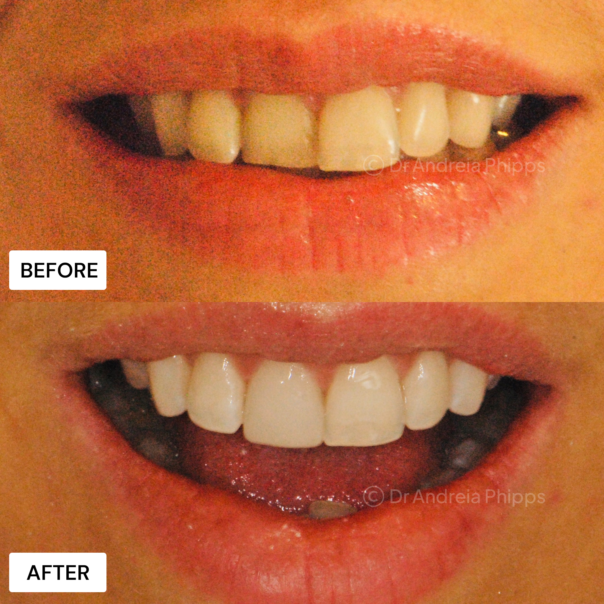 Smile Gallery